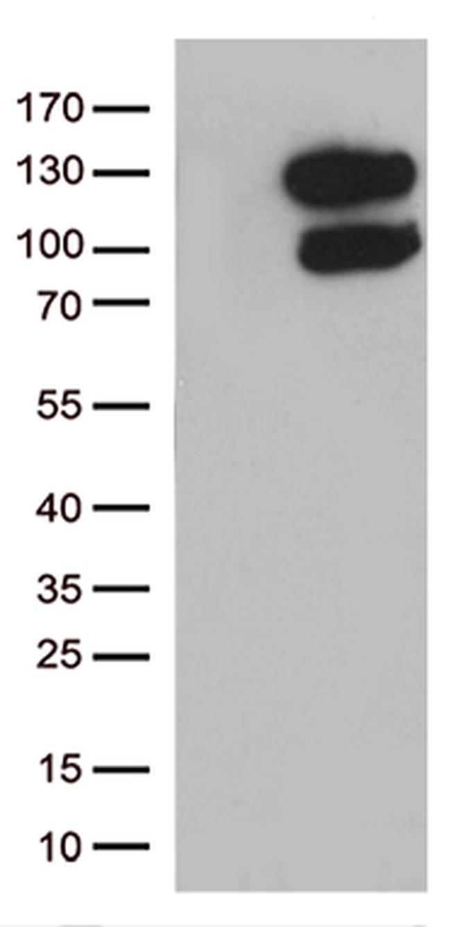 VPS50 Antibody in Western Blot (WB)