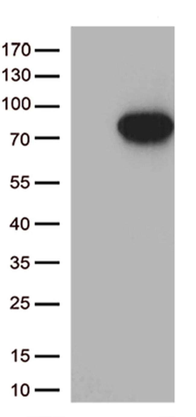 MASP2 Antibody in Western Blot (WB)