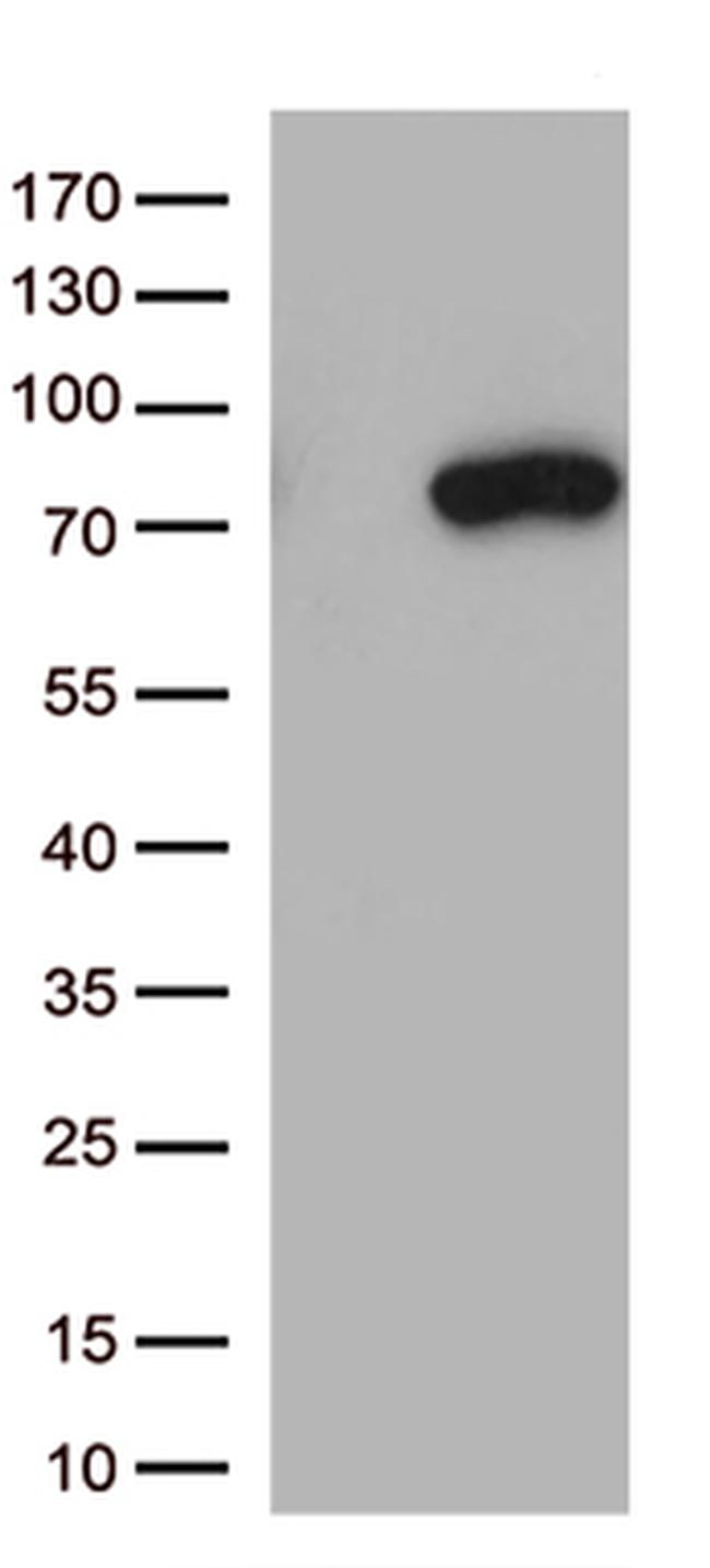 MASP2 Antibody in Western Blot (WB)