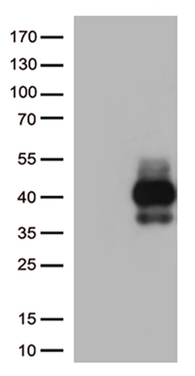 TIGIT Antibody in Western Blot (WB)