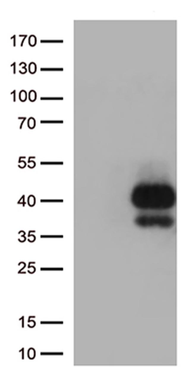 TIGIT Antibody in Western Blot (WB)