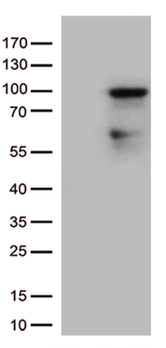 ZNF226 Antibody in Western Blot (WB)