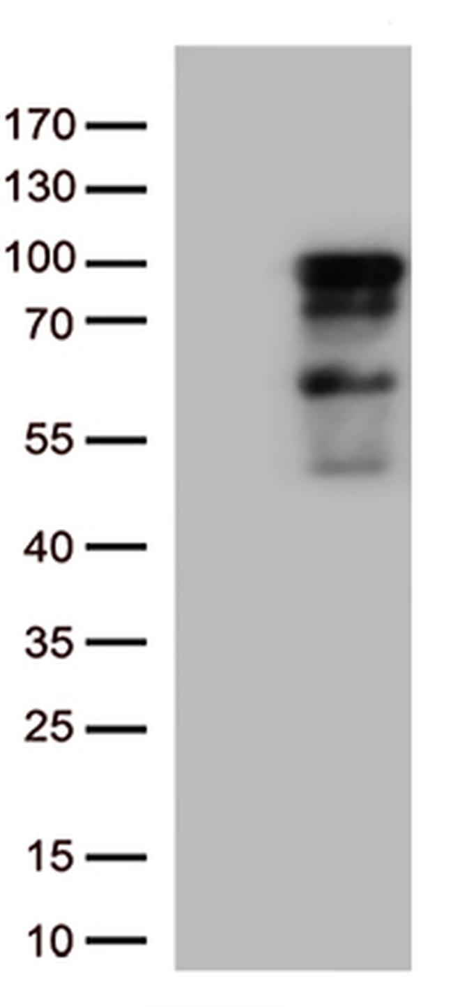 ZNF226 Antibody in Western Blot (WB)