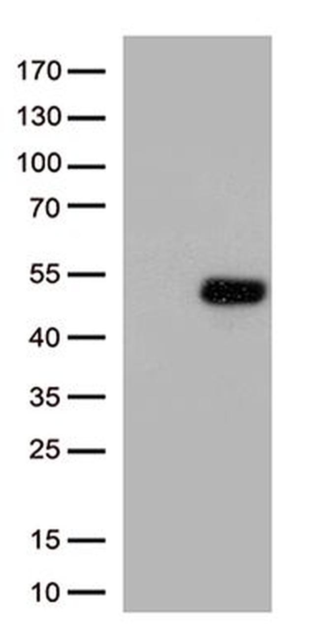 ATF4 Antibody in Western Blot (WB)