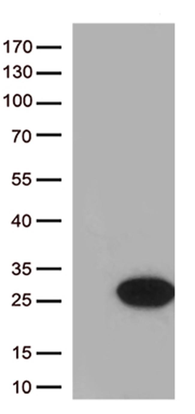 Cytoglobin (CYGB) Antibody in Western Blot (WB)