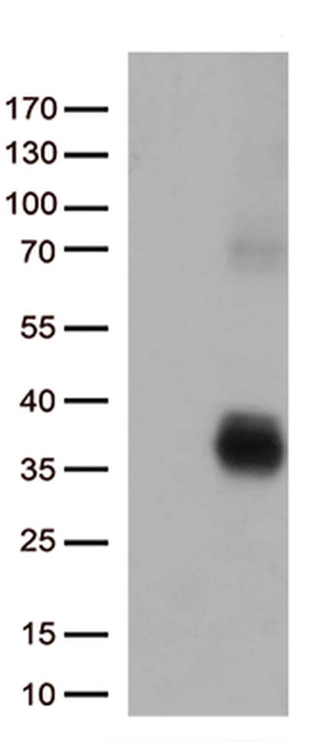 HLA-DQA2 Antibody in Western Blot (WB)