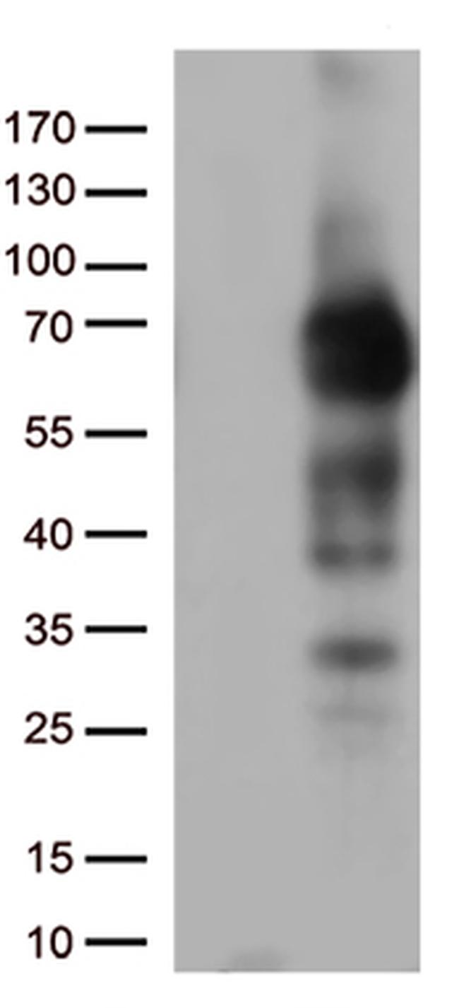 p75 NGF Receptor (NGFR) Antibody in Western Blot (WB)