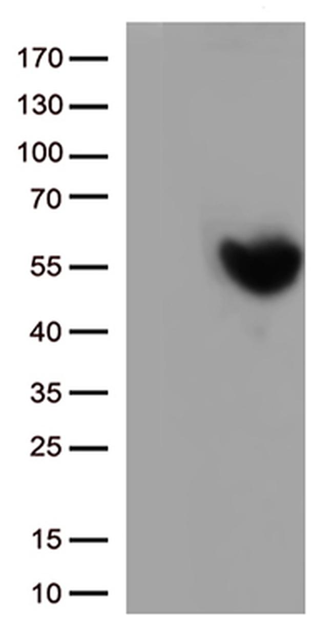 PD L1 (CD274) Antibody in Western Blot (WB)