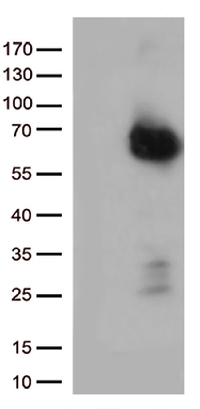 p75 NGF Receptor (NGFR) Antibody in Western Blot (WB)