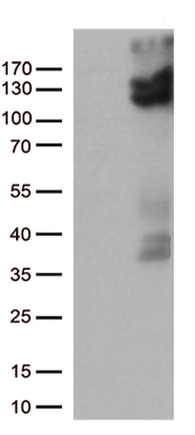 VRL1 (TRPV2) Antibody in Western Blot (WB)