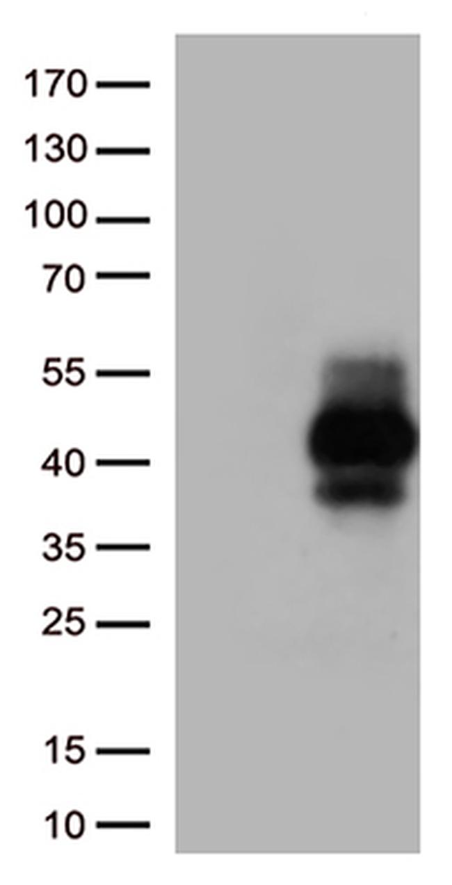 TIGIT Antibody in Western Blot (WB)