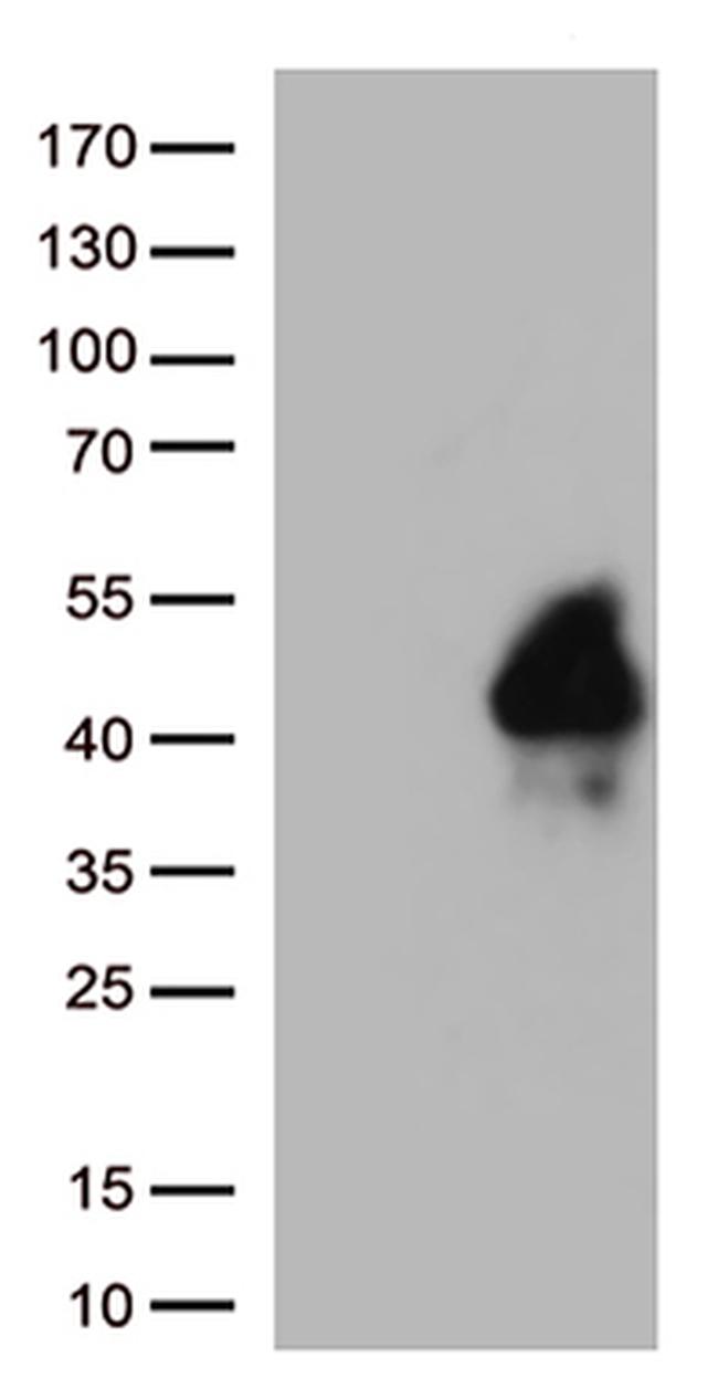 TIGIT Antibody in Western Blot (WB)