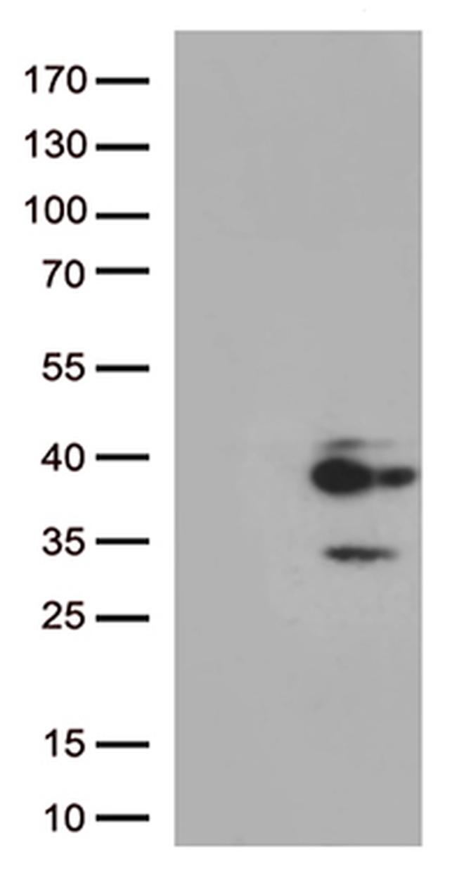 Major Basic Protein (PRG2) Antibody in Western Blot (WB)