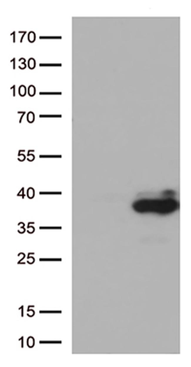 Major Basic Protein (PRG2) Antibody in Western Blot (WB)