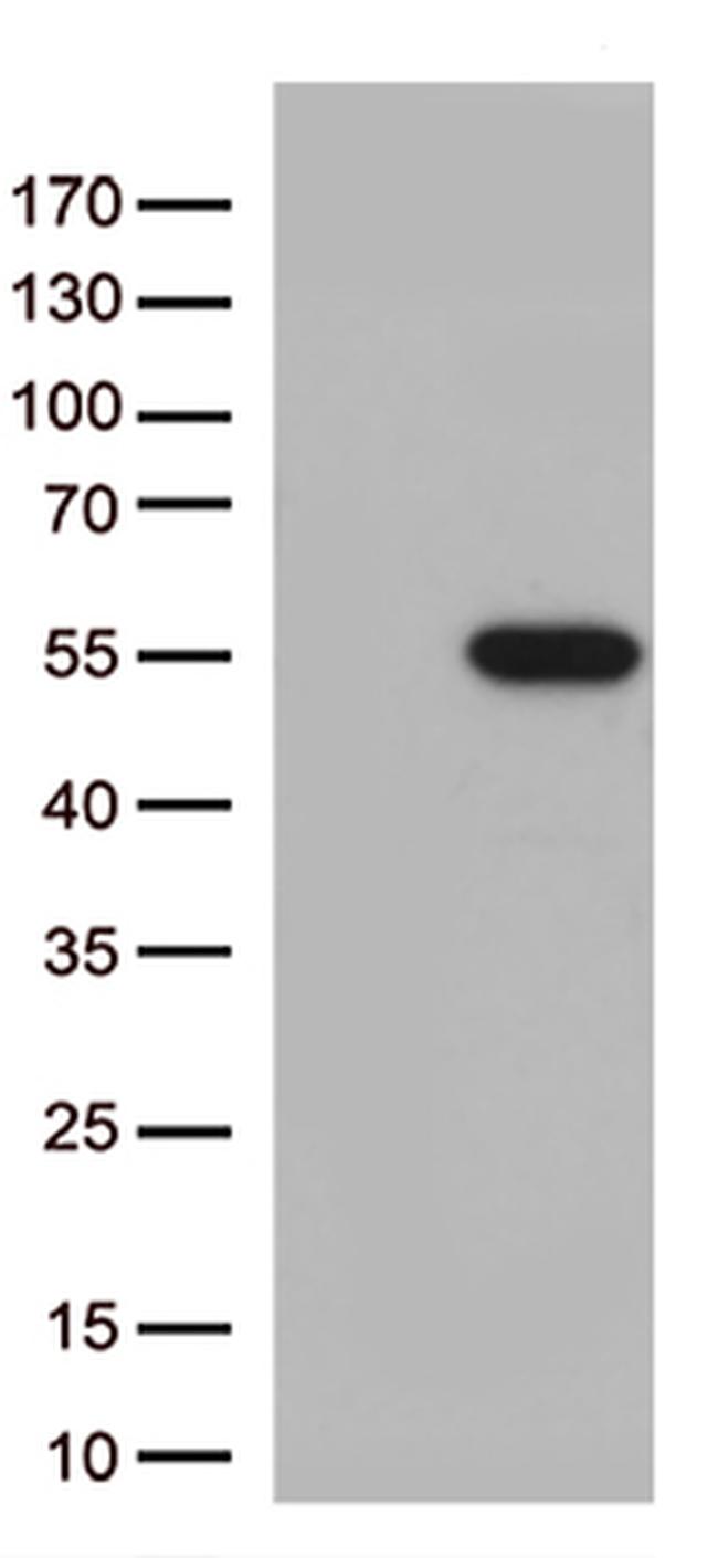 MTRF1 Antibody in Western Blot (WB)