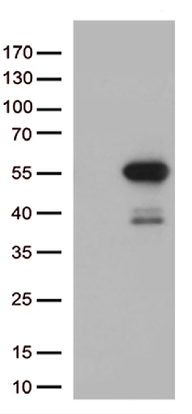MTRF1 Antibody in Western Blot (WB)