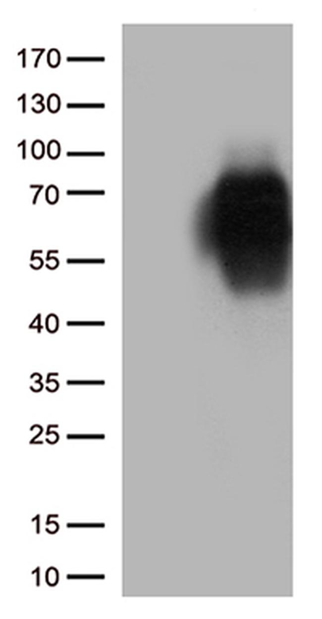 B7-2 (CD86) Antibody in Western Blot (WB)