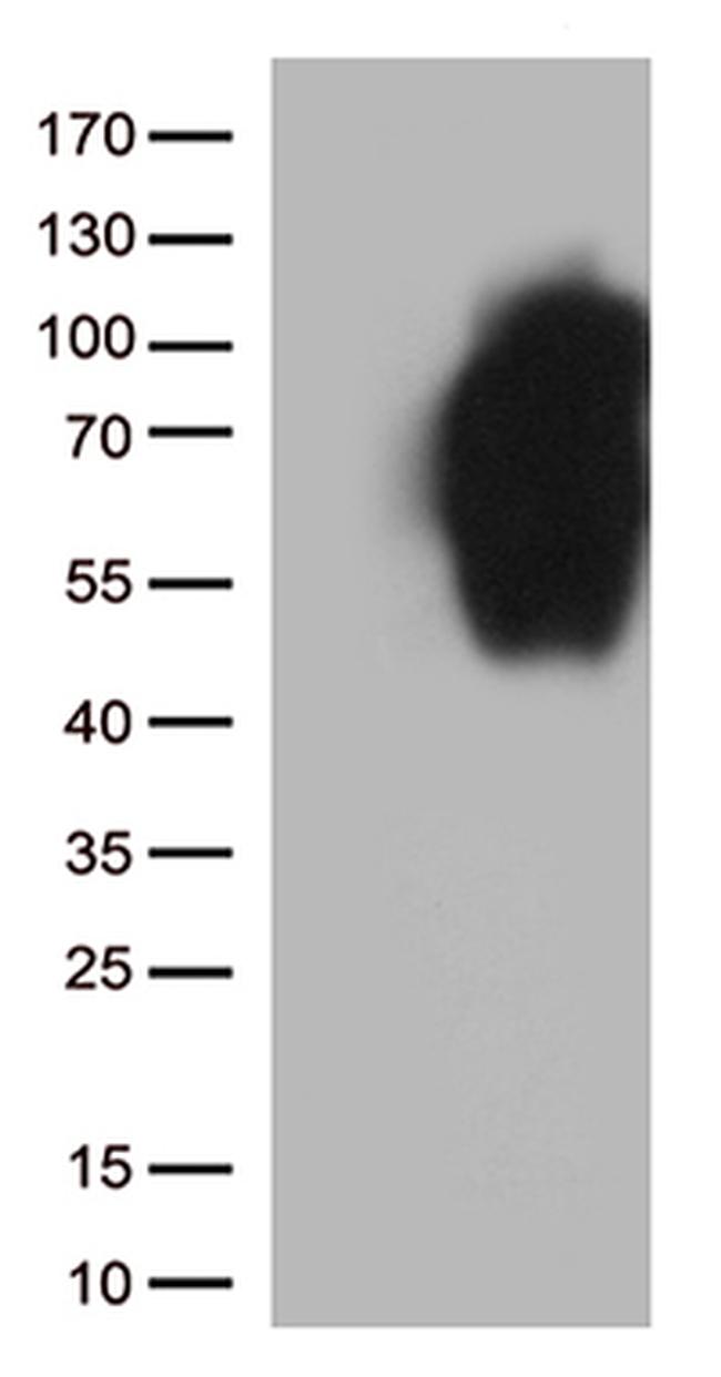 B7-2 (CD86) Antibody in Western Blot (WB)