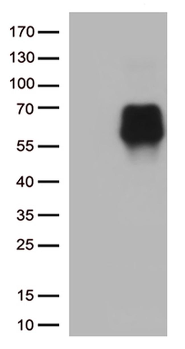 B7-2 (CD86) Antibody in Western Blot (WB)