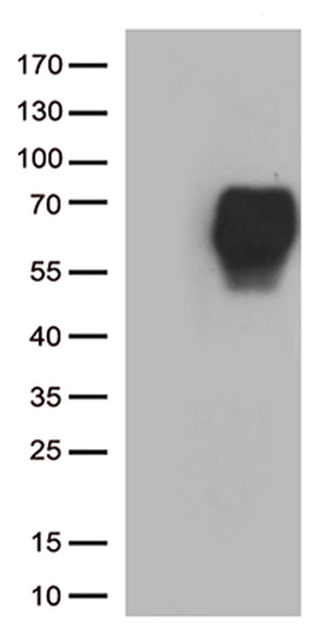 B7-2 (CD86) Antibody in Western Blot (WB)