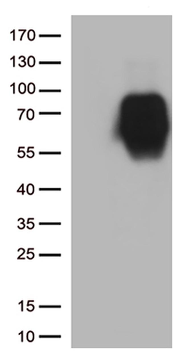 B7-2 (CD86) Antibody in Western Blot (WB)