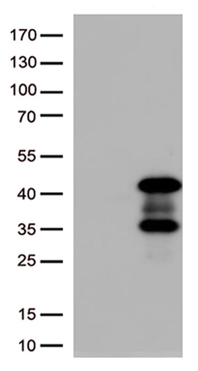 AMPK beta 1 (PRKAB1) Antibody in Western Blot (WB)