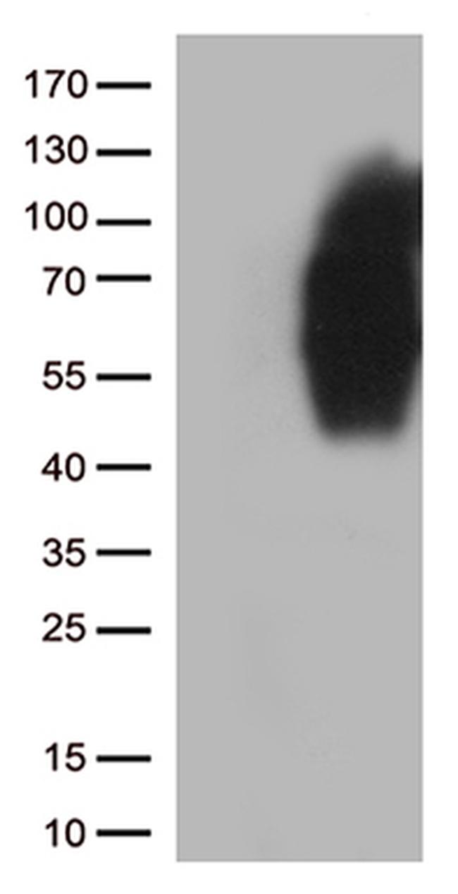 B7-2 (CD86) Antibody in Western Blot (WB)