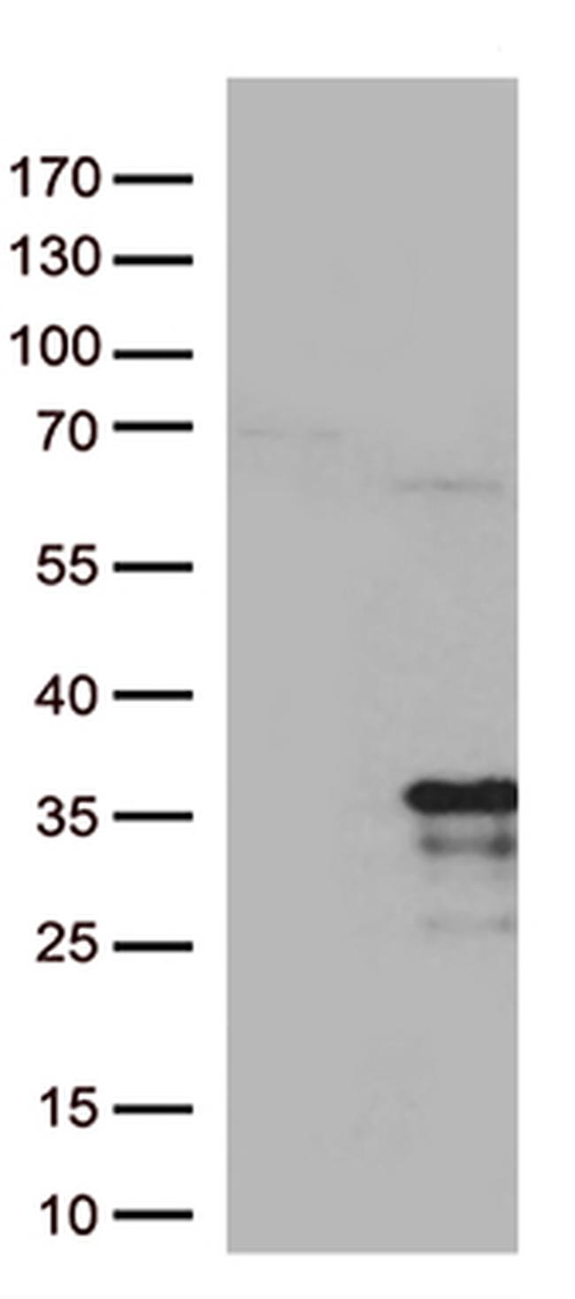 MRPL24 Antibody in Western Blot (WB)
