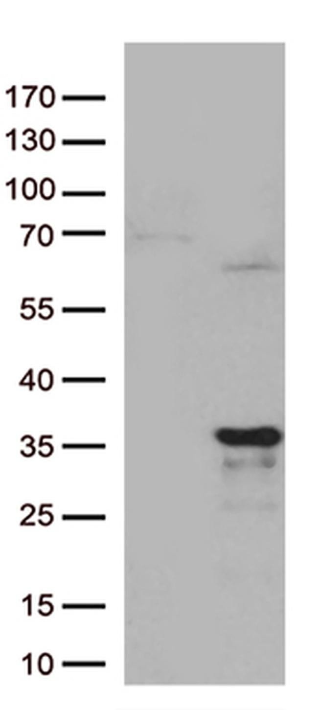 MRPL24 Antibody in Western Blot (WB)