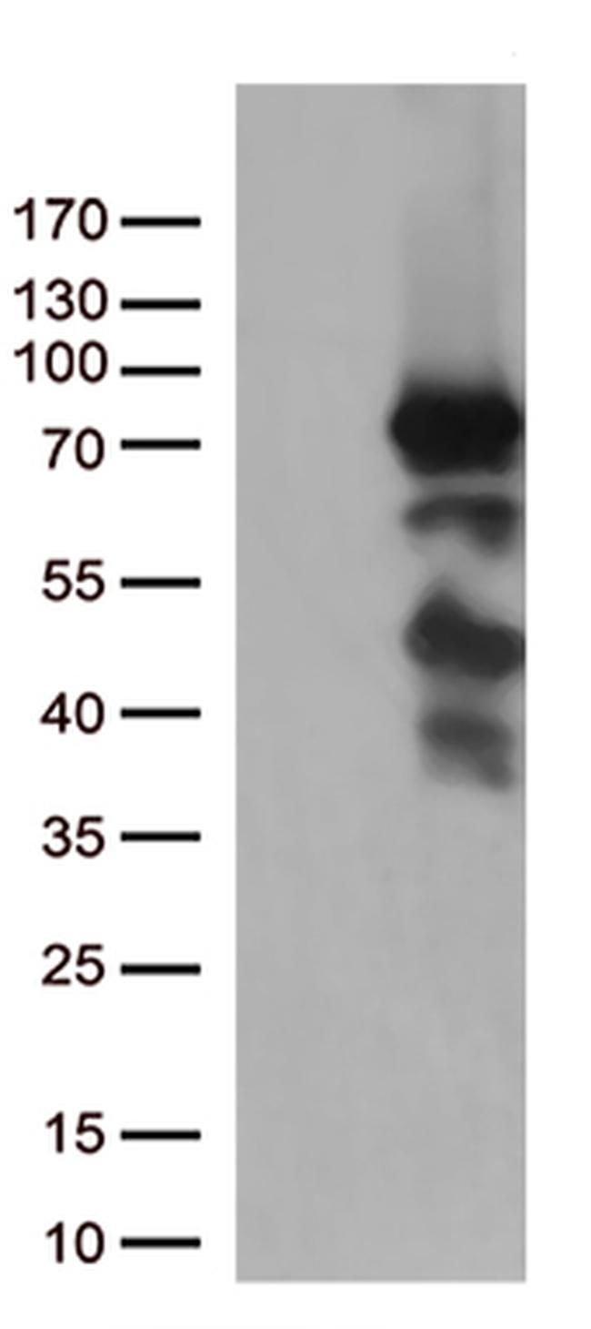 PDZK1 Antibody in Western Blot (WB)