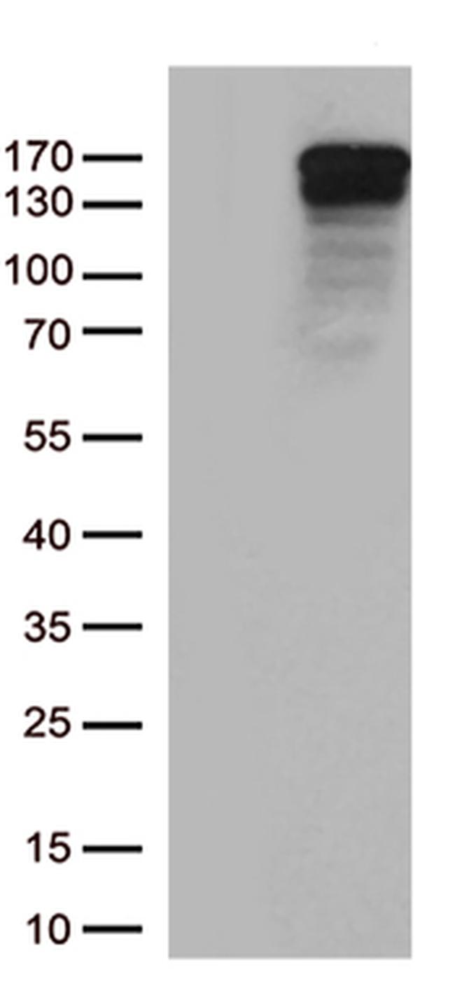 TRPS1 Antibody in Western Blot (WB)