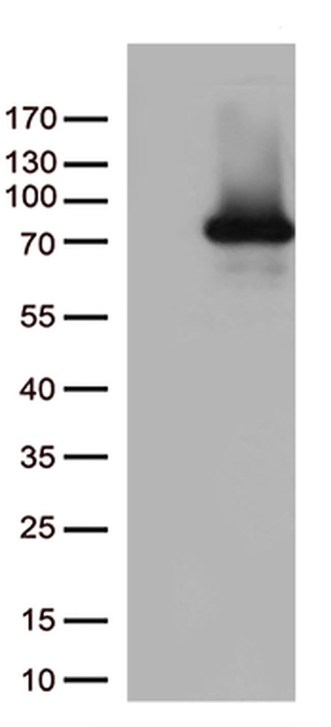 PDZK1 Antibody in Western Blot (WB)