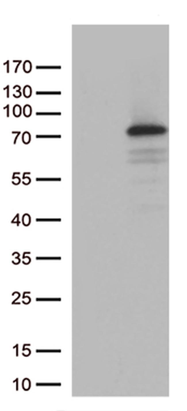 PDZK1 Antibody in Western Blot (WB)