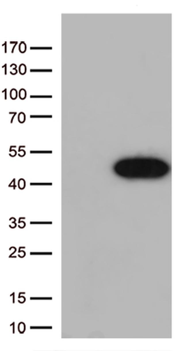 Arginase 1 (ARG1) Antibody in Western Blot (WB)