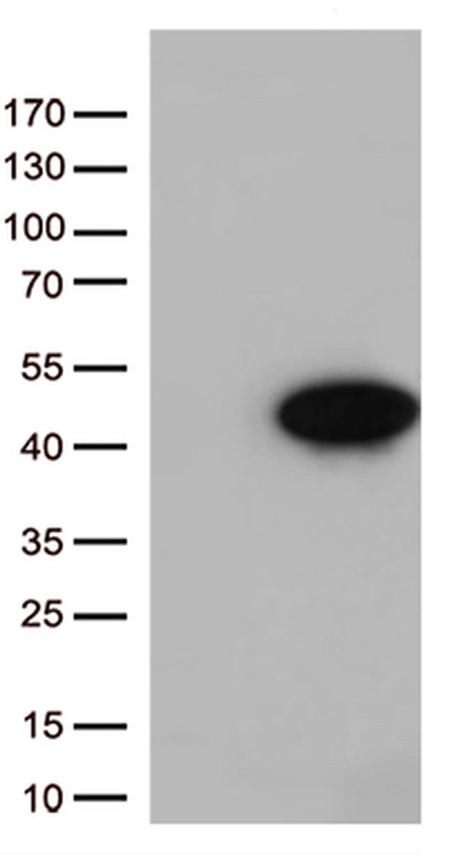 Arginase 1 (ARG1) Antibody in Western Blot (WB)
