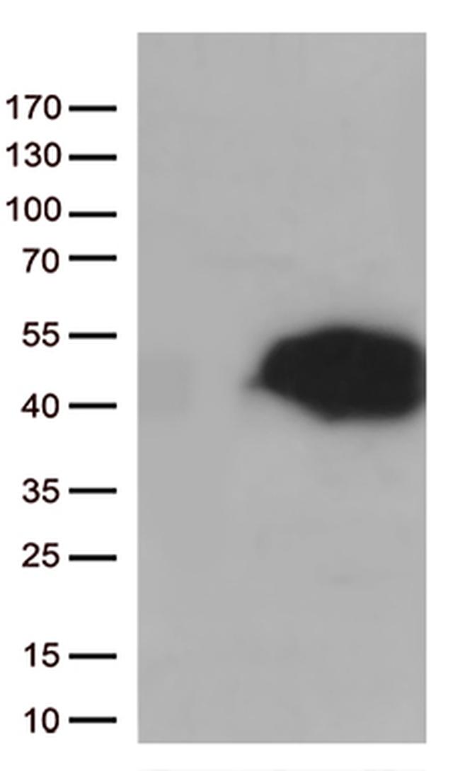 Arginase 1 (ARG1) Antibody in Western Blot (WB)