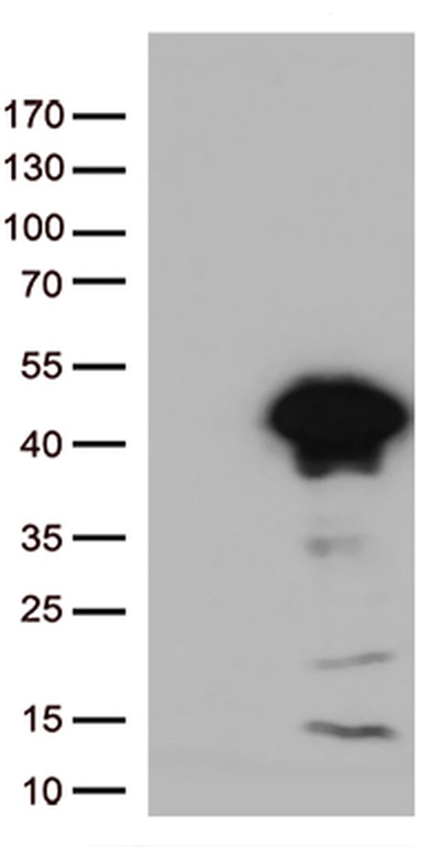 Arginase 1 (ARG1) Antibody in Western Blot (WB)