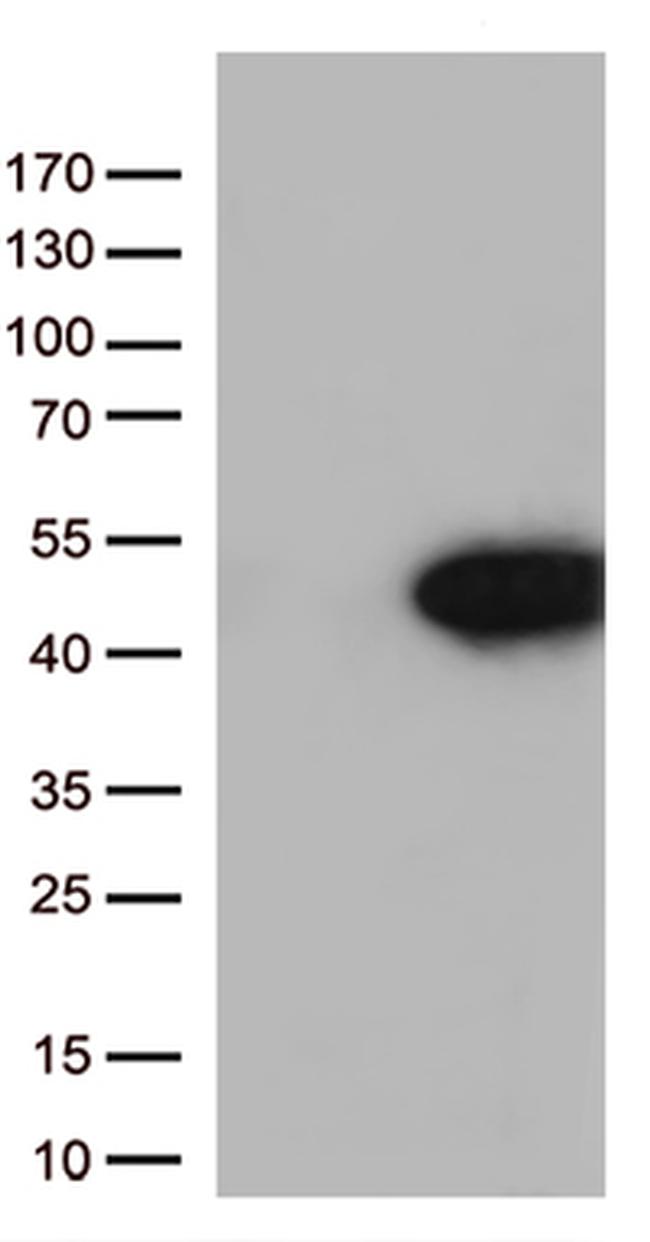 Arginase 1 (ARG1) Antibody in Western Blot (WB)