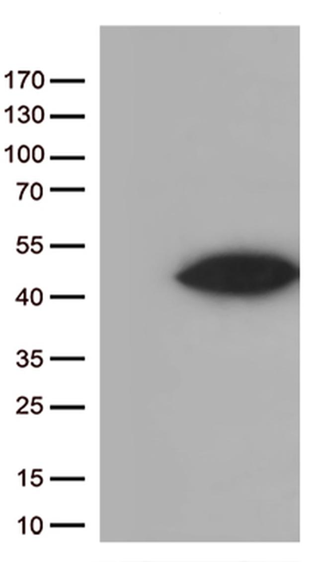 Arginase 1 (ARG1) Antibody in Western Blot (WB)