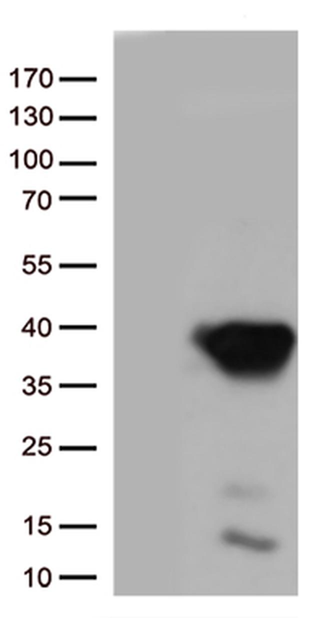 Caspase 3 (CASP3) Antibody in Western Blot (WB)