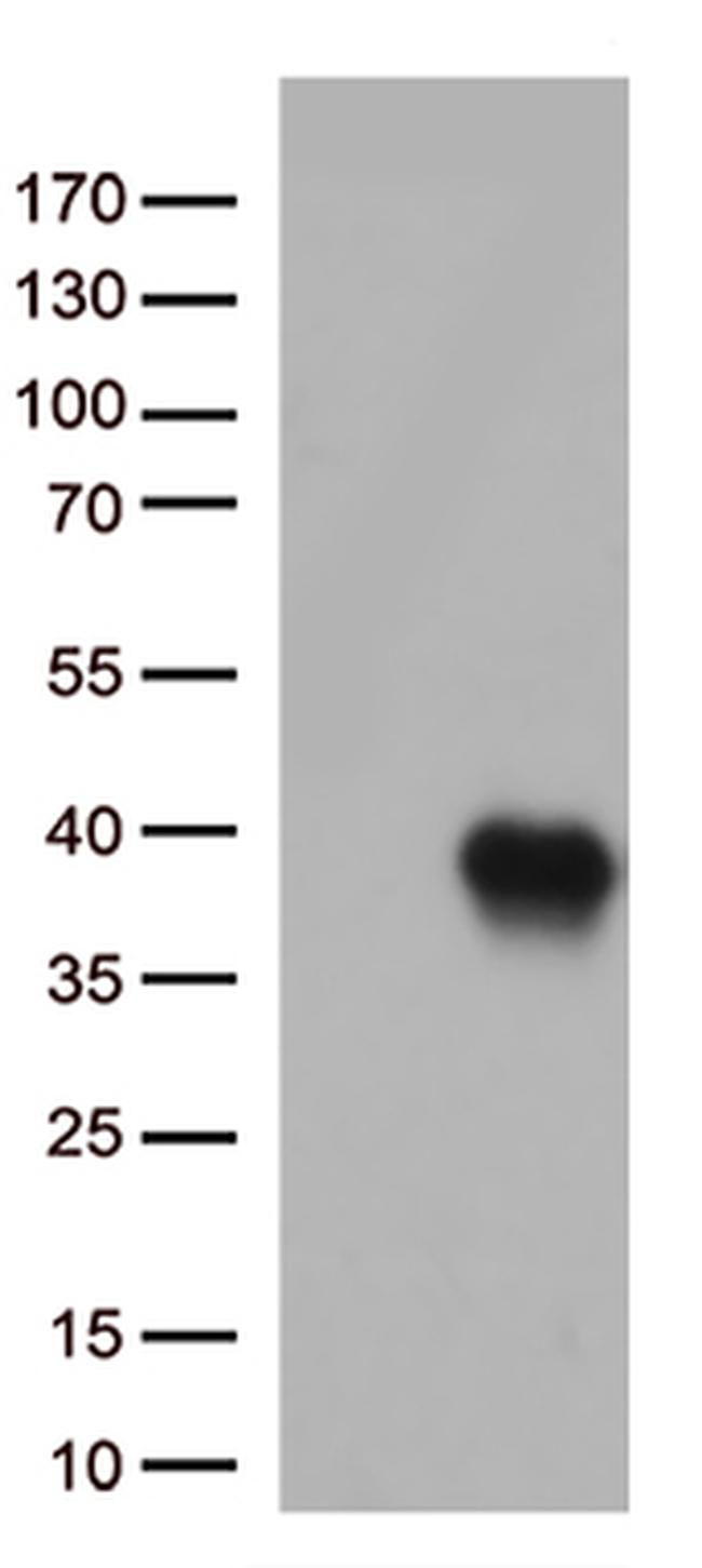 Caspase 3 (CASP3) Antibody in Western Blot (WB)