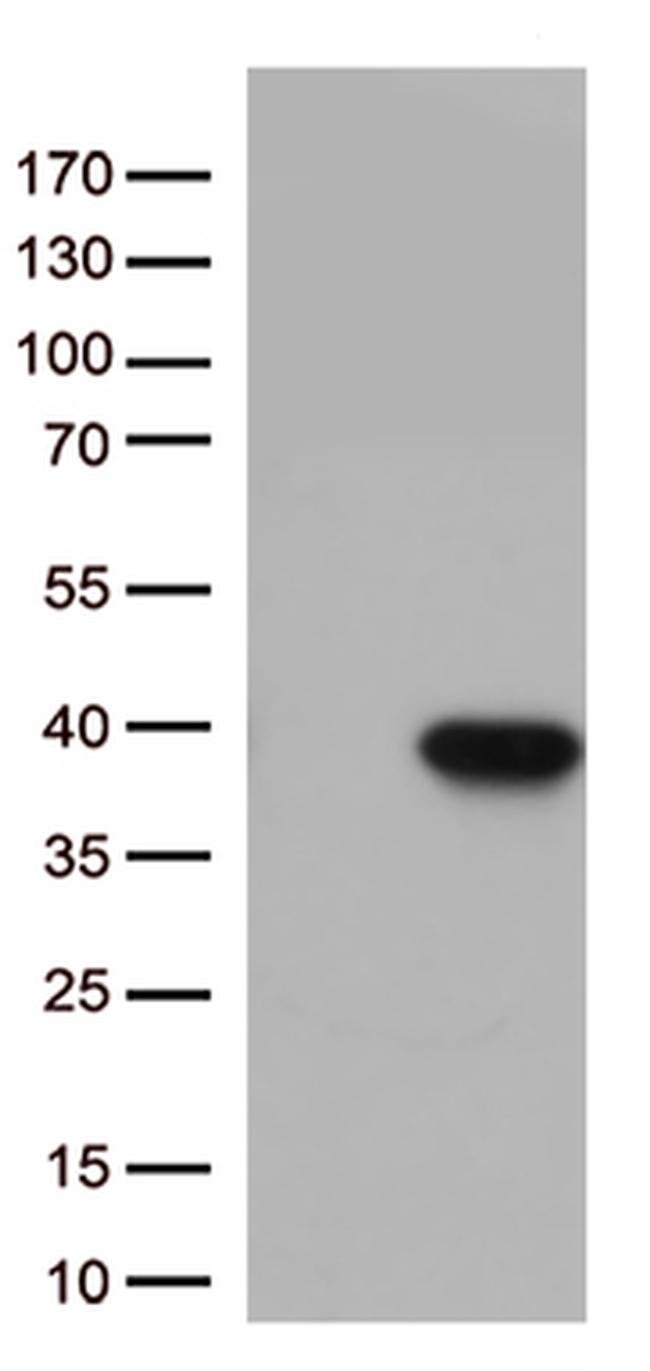 Caspase 3 (CASP3) Antibody in Western Blot (WB)
