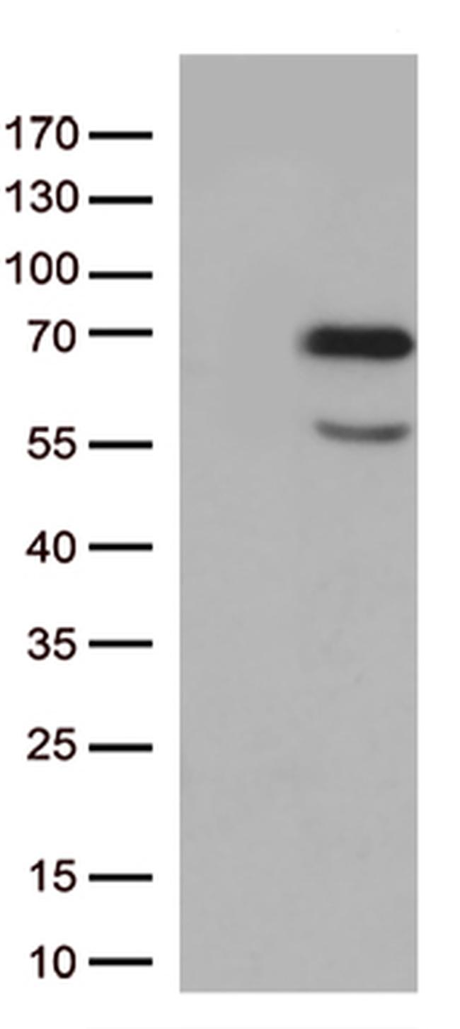 Nucleostemin (GNL3) Antibody in Western Blot (WB)