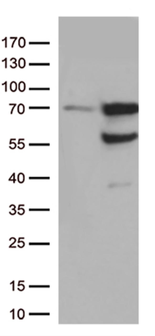 Nucleostemin (GNL3) Antibody in Western Blot (WB)