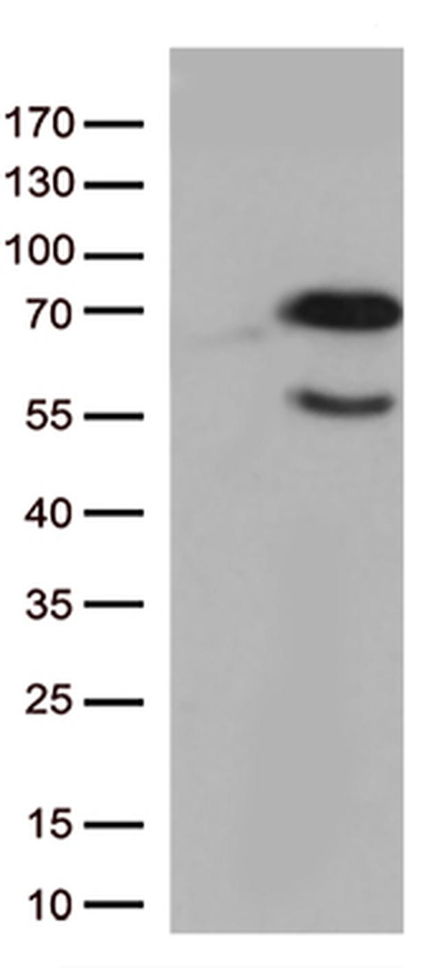 Nucleostemin (GNL3) Antibody in Western Blot (WB)