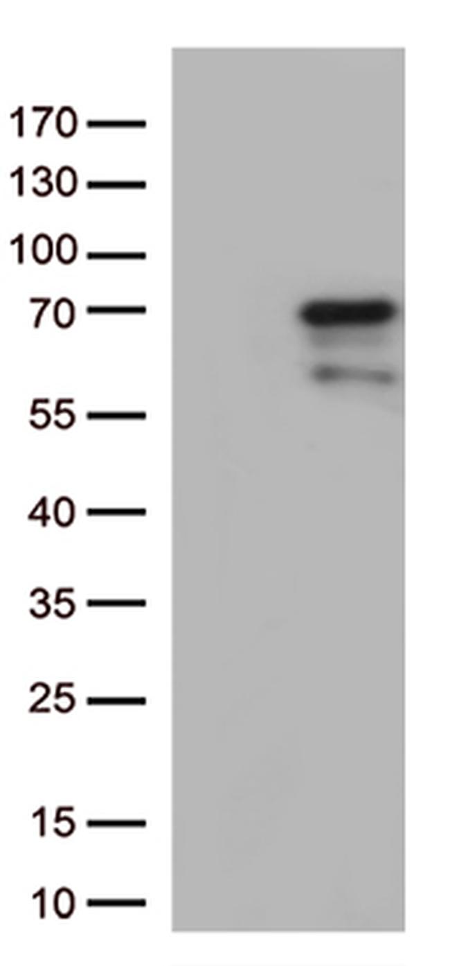 Nucleostemin (GNL3) Antibody in Western Blot (WB)
