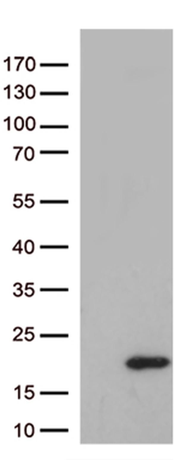 IL10 Antibody in Western Blot (WB)