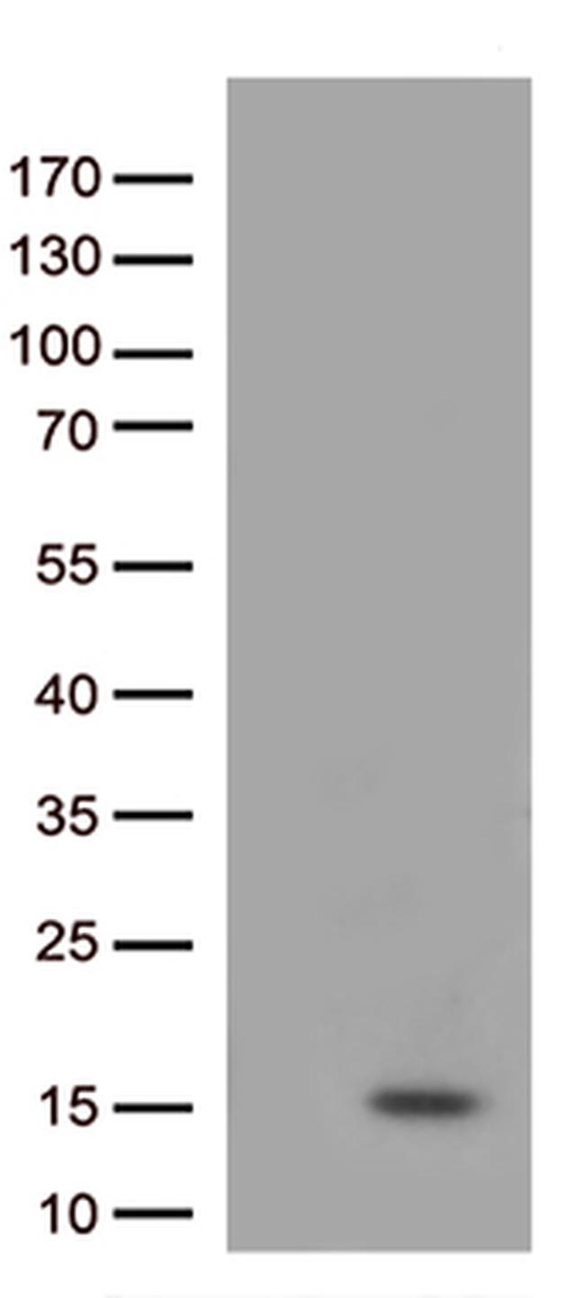 IL8 (CXCL8) Antibody in Western Blot (WB)