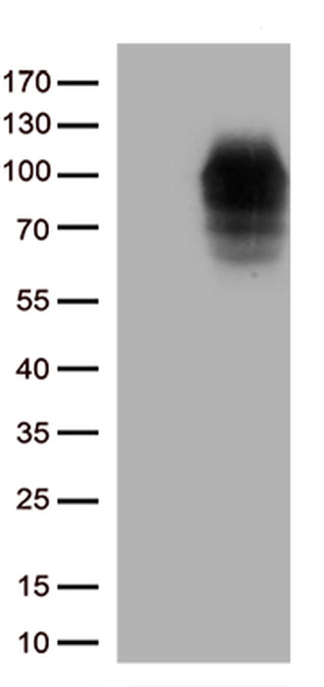 DDX4 Antibody in Western Blot (WB)