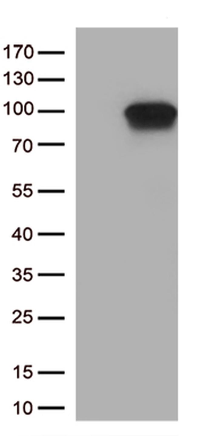 DDX4 Antibody in Western Blot (WB)